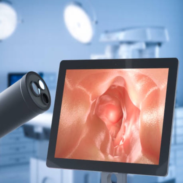 Enfermedad diverticular